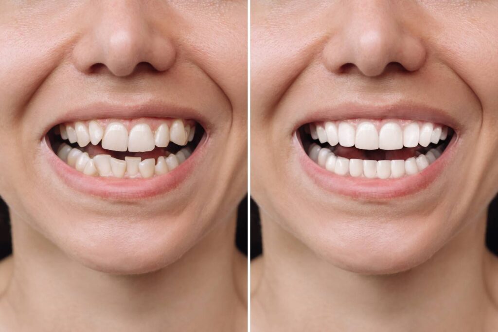 cosmetic dentist in islamabad