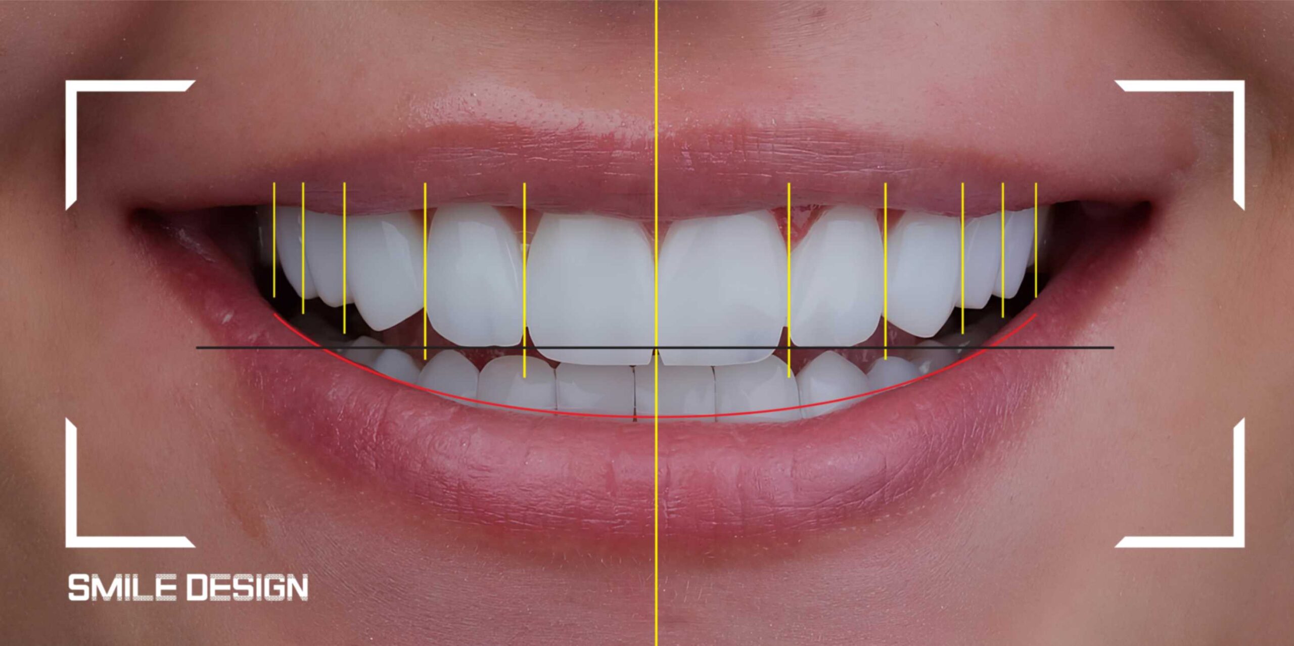 cosmetic dentist in islamabad